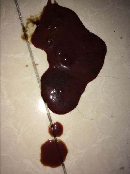 2个月小狗拉稀(是寄生虫在作怪吗)