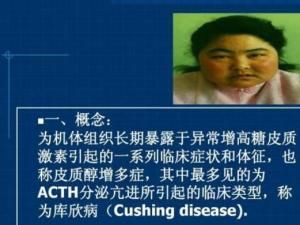 库兴氏综合症(该怎么判断和应对)
