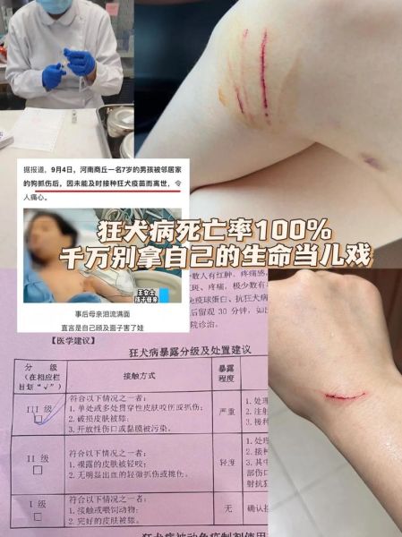 狂犬病的狗能活多久(会怎么死的呢)