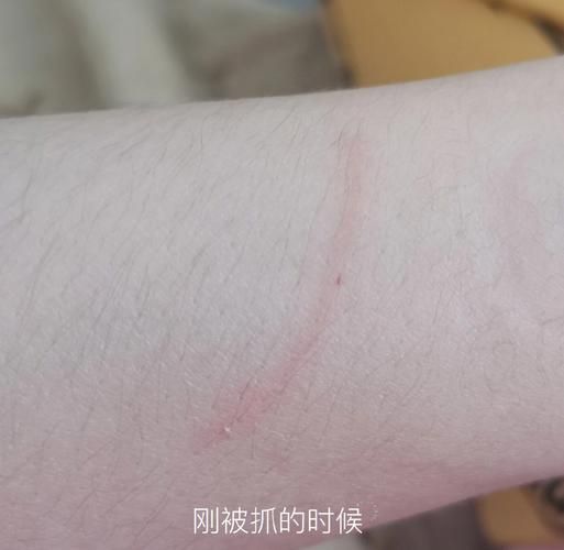 猫抓了一下出了点血要打疫苗吗?(打完针就安全了吗)