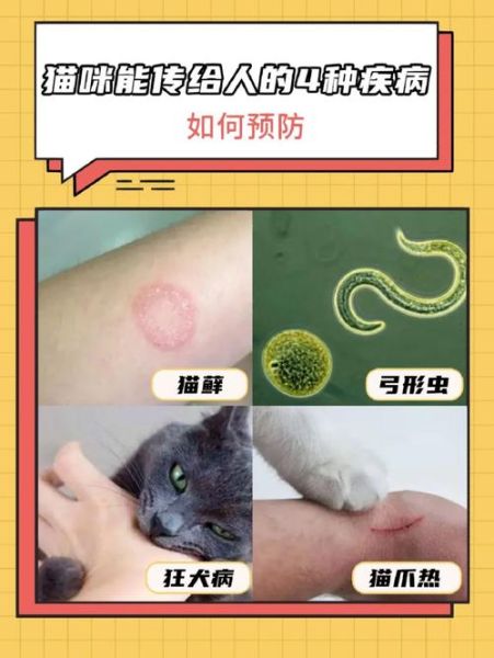 猫爪热( 怎么才能避免被猫抓热)
