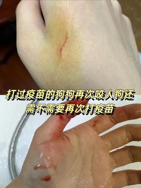 猫狂犬病( 猫咪真的会得狂犬病吗)