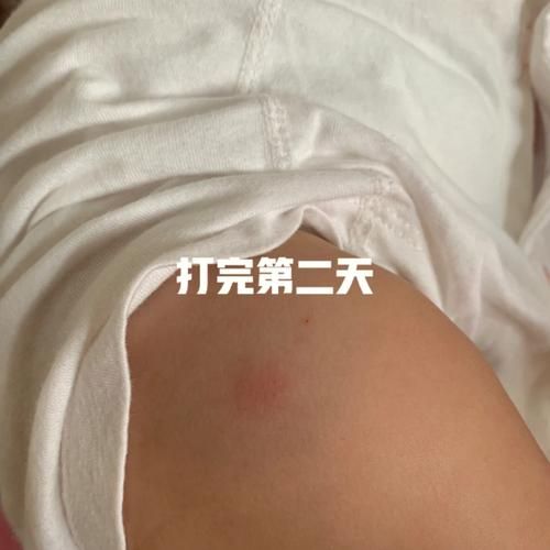 疫苗打完了突然就死了(是疫苗的问题还是个人体质)