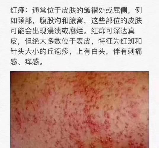 细小是什么病(是不是得了细小)