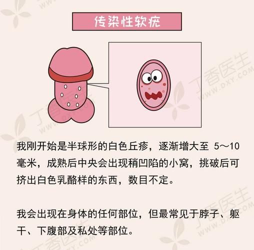 蚰蜓(它会传播疾病吗)