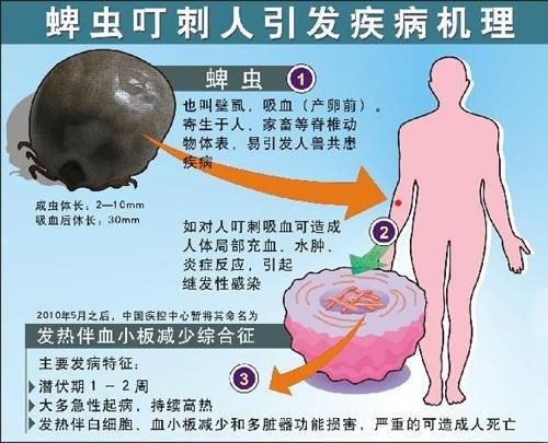 蜱虫最怕这3种东西(还有什么克星)
