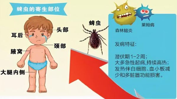蜱虱(怎么预防它叮咬)