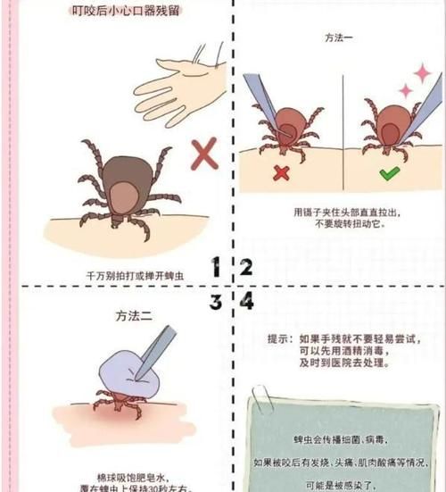 蜱虱(怎么预防它叮咬)