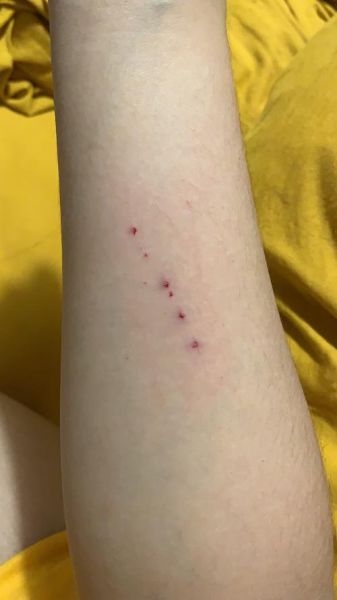 被猫抓伤怎么办( 该怎么处理伤口)